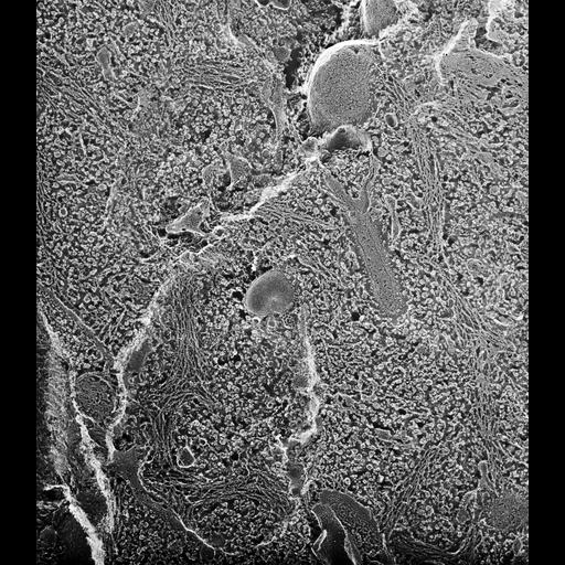  NCBI Organism:Paramecium multimicronucleatum; Cell Types:cell by organism, eukaryotic cell, , ; Cell Components:cytoplasm, clathrin coat of endocytic vesicle, coated pit, early endosome; Biological process:cytoplasm organization, endosome organization, clathrin coat assembly;