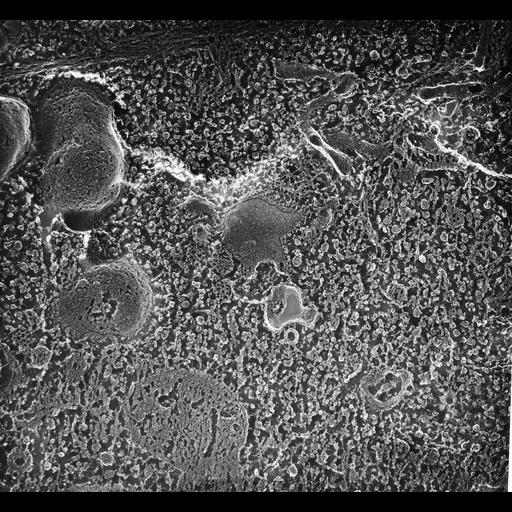  NCBI Organism:Paramecium multimicronucleatum; Cell Types:cell by organism, eukaryotic cell, , ; Cell Components:cytoplasm, cell cortex, endosome membrane, clathrin coat, microtubule basal body; Biological process:cytoplasm organization, endosome organization, clathrin coat assembly, microtubule basal body organization;