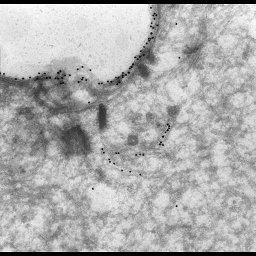  NCBI Organism:Paramecium multimicronucleatum; Cell Types:cell by organism, eukaryotic cell, , ; Cell Components:plasma membrane, early endosome membrane; Biological process:endosome organization