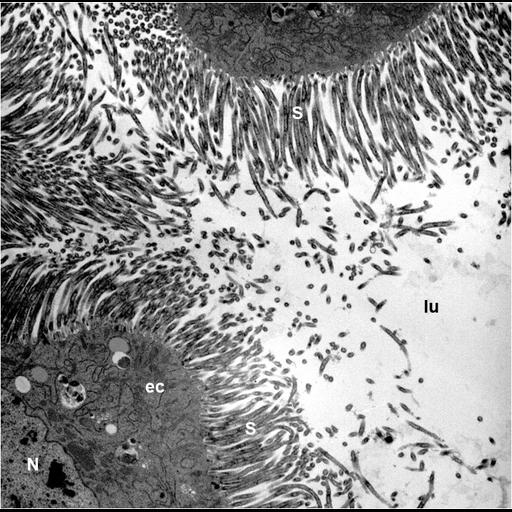  NCBI Organism:, , ; Cell Types:epithelial cell, ; Cell Components:nucleus, microvillus, cytoplasm; Biological process:detection of symbiotic bacterium