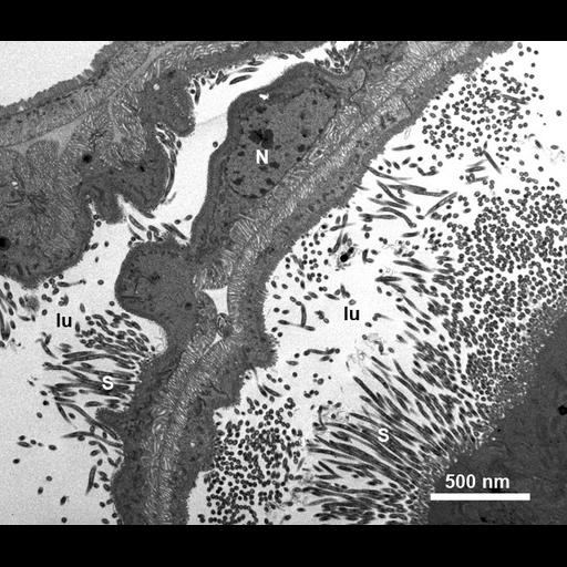  NCBI Organism:, , ; Cell Types:epithelial cell, ; Cell Components:nucleus, microvillus, cytoplasm; Biological process:detection of symbiotic bacterium