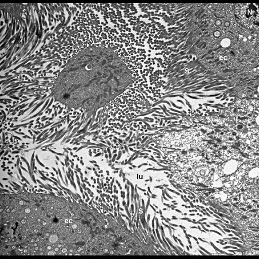  NCBI Organism:, , Mollicutes, ; Cell Types:epithelial cell, ; Cell Components:microvillus, nucleus, cytoplasm; Biological process:detection of symbiotic bacterium