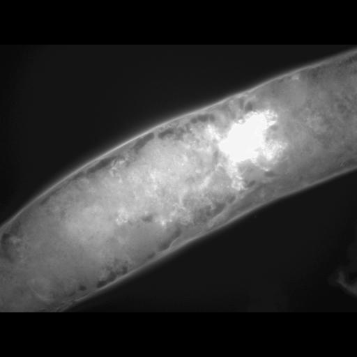  NCBI Organism:Caenorhabditis elegans; Cell Types:muscle cell Cell Components:actin filament Biological process:chronological cell aging