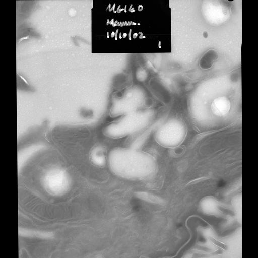  NCBI Organism:Rattus rattus; Cell Types:, glandular epithelial cell, milk secreting cell; Cell Components:smooth endoplasmic reticulum, lipid particle, Golgi medial cisterna, mitochondrion; Biological process:lipid storage, lactation, secretion;