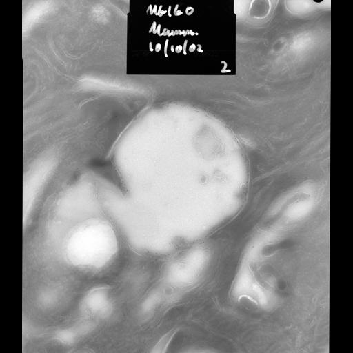  NCBI Organism:Rattus rattus; Cell Types:, glandular epithelial cell, milk secreting cell; Cell Components:smooth endoplasmic reticulum, lipid particle, Golgi medial cisterna, mitochondrion; Biological process:lipid storage, lactation, secretion;