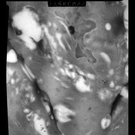  NCBI Organism:Rattus rattus; Cell Types:, glandular epithelial cell, milk secreting cell; Cell Components:smooth endoplasmic reticulum, lipid particle, trans-Golgi network, mitochondrion; Biological process:lactation, secretion, lipid storage;