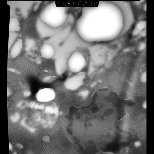  NCBI Organism:Rattus rattus; Cell Types:, glandular epithelial cell, milk secreting cell; Cell Components:smooth endoplasmic reticulum, lipid particle, trans-Golgi network, mitochondrion; Biological process:lactation, secretion, lipid storage;