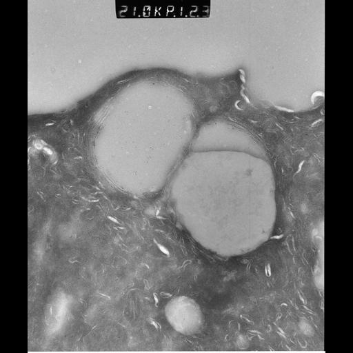  NCBI Organism:Rattus rattus; Cell Types:, glandular epithelial cell, milk secreting cell; Cell Components:smooth endoplasmic reticulum, lipid particle, trans-Golgi network, mitochondrion; Biological process:lipid storage, lactation, secretion;