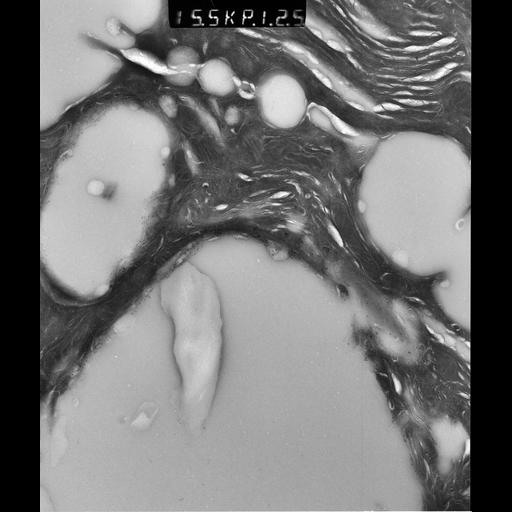  NCBI Organism:Rattus rattus; Cell Types:, glandular epithelial cell, milk secreting cell; Cell Components:smooth endoplasmic reticulum, lipid particle, trans-Golgi network, mitochondrion; Biological process:lipid storage, lactation, secretion;