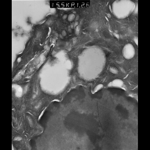  NCBI Organism:Rattus rattus; Cell Types:, glandular epithelial cell, milk secreting cell; Cell Components:smooth endoplasmic reticulum, lipid particle, trans-Golgi network, mitochondrion; Biological process:lipid storage, lactation, secretion;