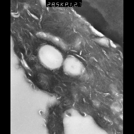  NCBI Organism:Rattus rattus; Cell Types:, glandular epithelial cell, milk secreting cell; Cell Components:smooth endoplasmic reticulum, lipid particle, trans-Golgi network, mitochondrion; Biological process:lipid storage, lactation, secretion;