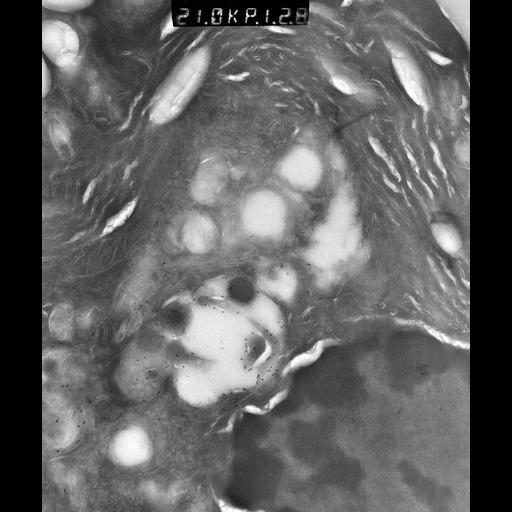  NCBI Organism:Rattus rattus; Cell Types:, glandular epithelial cell, milk secreting cell; Cell Components:smooth endoplasmic reticulum, lipid particle, trans-Golgi network, mitochondrion; Biological process:lipid storage, lactation, secretion;