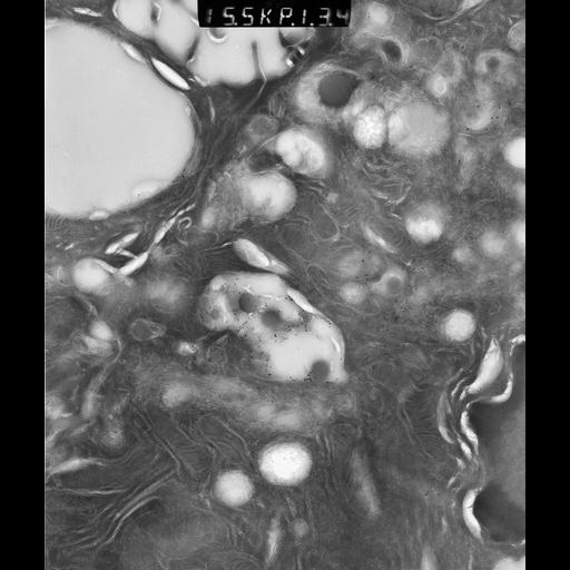  NCBI Organism:Rattus rattus; Cell Types:, glandular epithelial cell, milk secreting cell; Cell Components:smooth endoplasmic reticulum, lipid particle, trans-Golgi network, mitochondrion; Biological process:lipid storage, lactation, secretion;