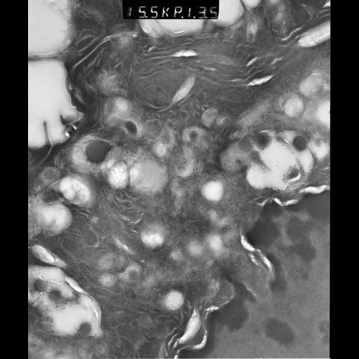  NCBI Organism:Rattus rattus; Cell Types:, glandular epithelial cell, milk secreting cell; Cell Components:smooth endoplasmic reticulum, lipid particle, trans-Golgi network, mitochondrion; Biological process:lipid storage, lactation, secretion;