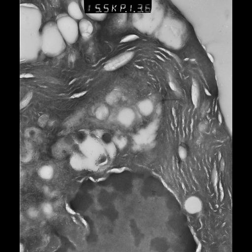  NCBI Organism:Rattus rattus; Cell Types:, glandular epithelial cell, milk secreting cell; Cell Components:smooth endoplasmic reticulum, lipid particle, trans-Golgi network, mitochondrion; Biological process:lipid storage, lactation, secretion;