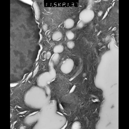  NCBI Organism:Rattus rattus; Cell Types:, glandular epithelial cell, milk secreting cell; Cell Components:smooth endoplasmic reticulum, lipid particle, trans-Golgi network, mitochondrion; Biological process:lipid storage, lactation, secretion;