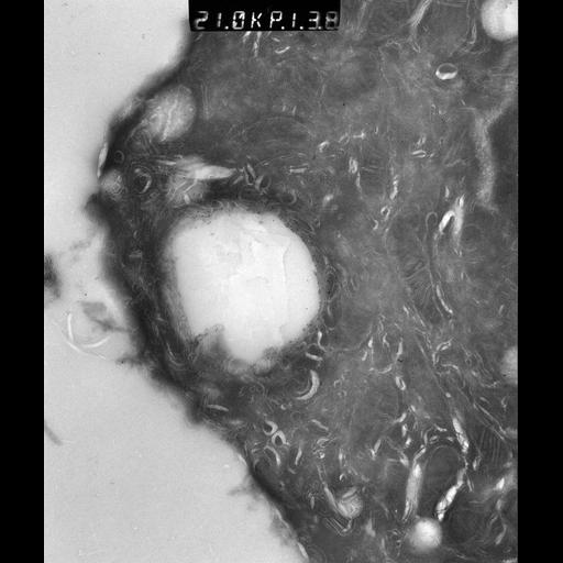  NCBI Organism:Rattus rattus; Cell Types:, glandular epithelial cell, milk secreting cell; Cell Components:smooth endoplasmic reticulum, lipid particle, trans-Golgi network, mitochondrion; Biological process:lipid storage, lactation, secretion;