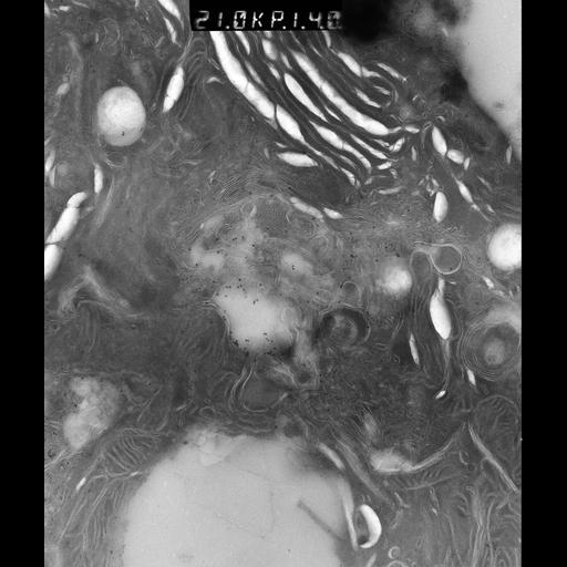  NCBI Organism:Rattus rattus; Cell Types:, glandular epithelial cell, milk secreting cell; Cell Components:smooth endoplasmic reticulum, lipid particle, trans-Golgi network, mitochondrion; Biological process:lipid storage, lactation, secretion;