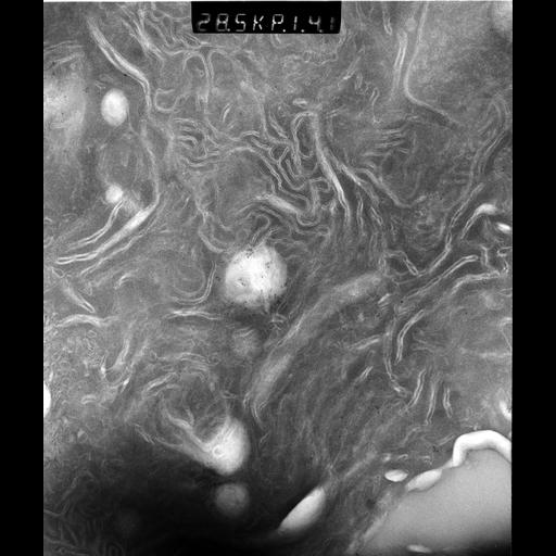  NCBI Organism:Rattus rattus; Cell Types:, glandular epithelial cell, milk secreting cell; Cell Components:smooth endoplasmic reticulum, lipid particle, trans-Golgi network, mitochondrion; Biological process:lipid storage, lactation, secretion;