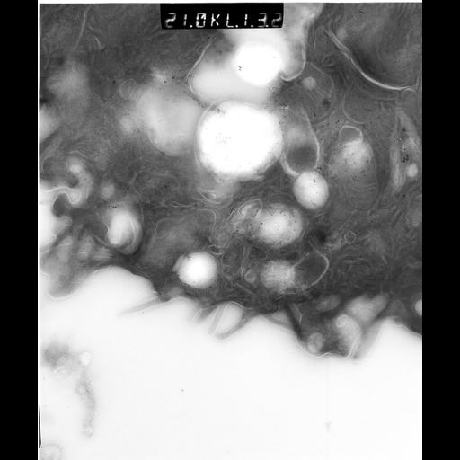  NCBI Organism:Rattus rattus; Cell Types:, glandular epithelial cell, milk secreting cell; Cell Components:smooth endoplasmic reticulum, lipid particle, trans-Golgi network, mitochondrion; Biological process:lipid storage, lactation, secretion;