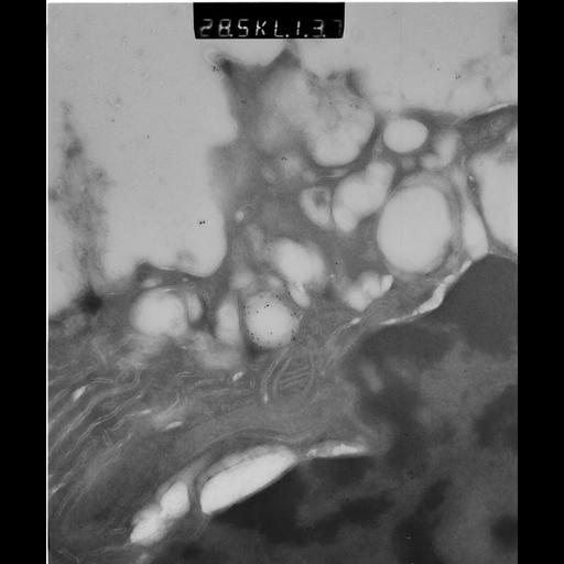  NCBI Organism:Rattus rattus; Cell Types:, glandular epithelial cell, milk secreting cell; Cell Components:smooth endoplasmic reticulum, lipid particle, trans-Golgi network, mitochondrion; Biological process:lipid storage, lactation, secretion;