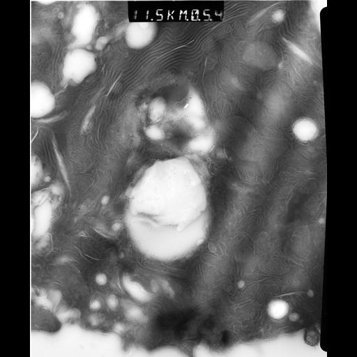  NCBI Organism:Rattus rattus; Cell Types:, glandular epithelial cell, milk secreting cell; Cell Components:smooth endoplasmic reticulum, lipid particle, trans-Golgi network, mitochondrion; Biological process:lipid storage, lactation, secretion;