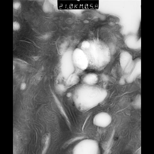  NCBI Organism:Rattus rattus; Cell Types:, glandular epithelial cell, milk secreting cell; Cell Components:smooth endoplasmic reticulum, lipid particle, trans-Golgi network, mitochondrion; Biological process:lipid storage, lactation, secretion;