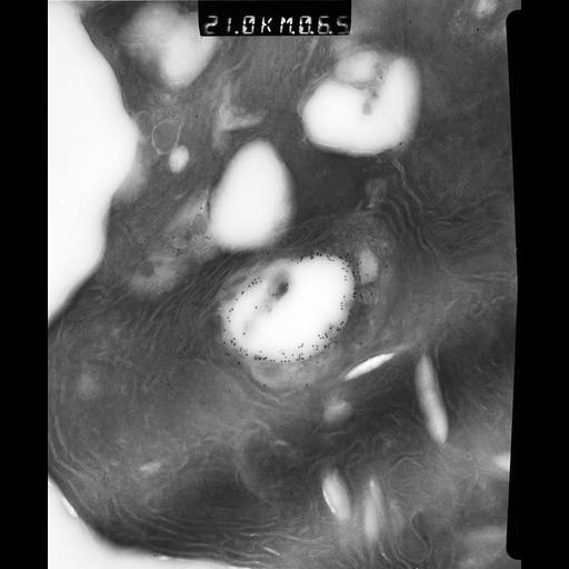  NCBI Organism:Rattus rattus; Cell Types:, glandular epithelial cell, milk secreting cell; Cell Components:smooth endoplasmic reticulum, lipid particle, trans-Golgi network, mitochondrion; Biological process:lipid storage, lactation, secretion;