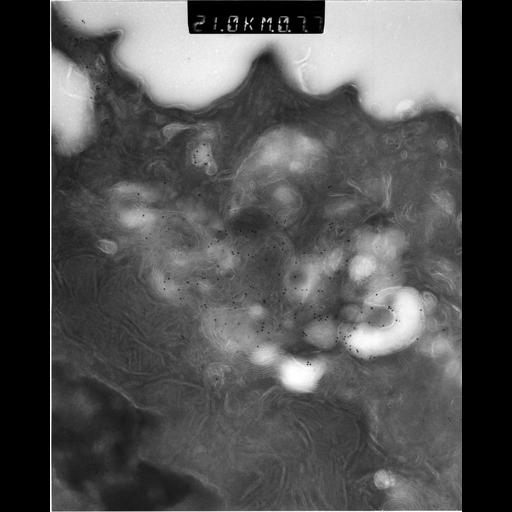  NCBI Organism:Rattus rattus; Cell Types:, glandular epithelial cell, milk secreting cell; Cell Components:smooth endoplasmic reticulum, lipid particle, trans-Golgi network, mitochondrion; Biological process:lipid storage, lactation, secretion;