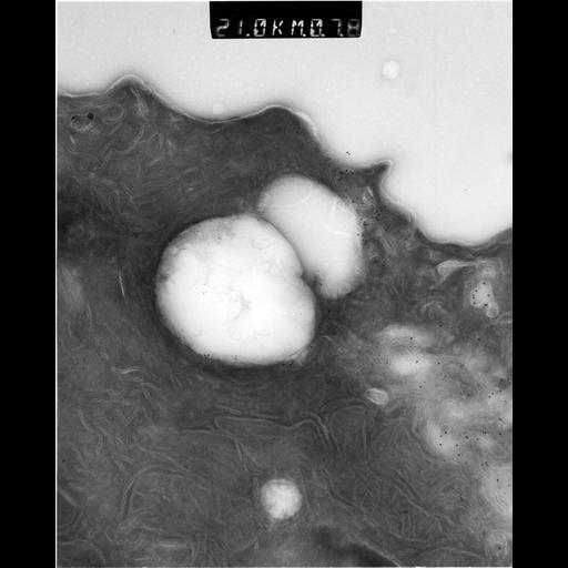  NCBI Organism:Rattus rattus; Cell Types:, glandular epithelial cell, milk secreting cell; Cell Components:smooth endoplasmic reticulum, lipid particle, trans-Golgi network, mitochondrion; Biological process:lipid storage, lactation, secretion;