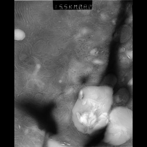  NCBI Organism:Rattus rattus; Cell Types:, glandular epithelial cell, milk secreting cell; Cell Components:smooth endoplasmic reticulum, lipid particle, trans-Golgi network, mitochondrion; Biological process:lipid storage, lactation, secretion;