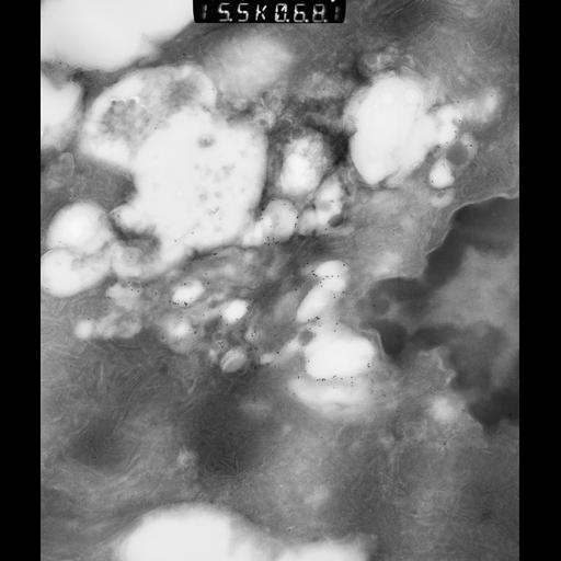  NCBI Organism:Rattus rattus; Cell Types:, glandular epithelial cell, milk secreting cell; Cell Components:smooth endoplasmic reticulum, lipid particle, trans-Golgi network, mitochondrion; Biological process:lipid storage, lactation, secretion;