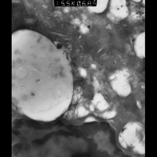  NCBI Organism:Rattus rattus; Cell Types:, glandular epithelial cell, milk secreting cell; Cell Components:smooth endoplasmic reticulum, lipid particle, trans-Golgi network, mitochondrion; Biological process:lipid storage, lactation, secretion;