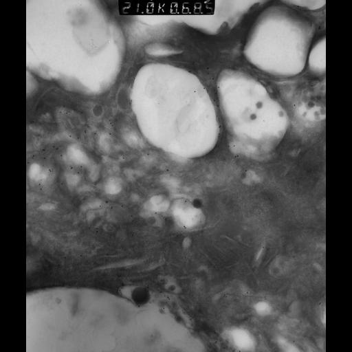  NCBI Organism:Rattus rattus; Cell Types:, glandular epithelial cell, milk secreting cell; Cell Components:smooth endoplasmic reticulum, lipid particle, trans-Golgi network, mitochondrion; Biological process:lipid storage, lactation, secretion;