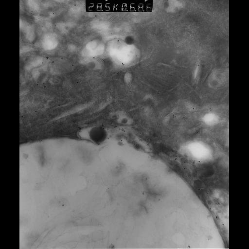  NCBI Organism:Rattus rattus; Cell Types:, glandular epithelial cell, milk secreting cell; Cell Components:smooth endoplasmic reticulum, lipid particle, trans-Golgi network, mitochondrion; Biological process:lipid storage, lactation, secretion;