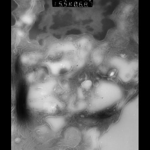  NCBI Organism:Rattus rattus; Cell Types:, glandular epithelial cell, milk secreting cell; Cell Components:smooth endoplasmic reticulum, lipid particle, trans-Golgi network, mitochondrion; Biological process:lipid storage, lactation, secretion;