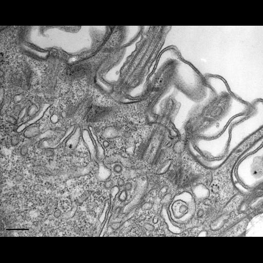  NCBI Organism:Paramecium multimicronucleatum; Cell Types:cell by organism, eukaryotic cell, , ; Cell Components:cell cortex, coated pit, endosome, cell cortex, axoneme; Biological process:, endosome organization, clathrin coating of Golgi vesicle, plasma membrane to endosome targeting;