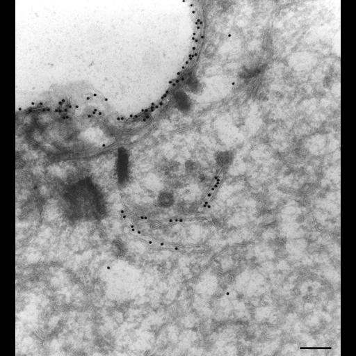  NCBI Organism:Paramecium multimicronucleatum; Cell Types:cell by organism, eukaryotic cell, , ; Cell Components:plasma membrane, early endosome, ; Biological process:endosome organization, early endosome to late endosome transport;