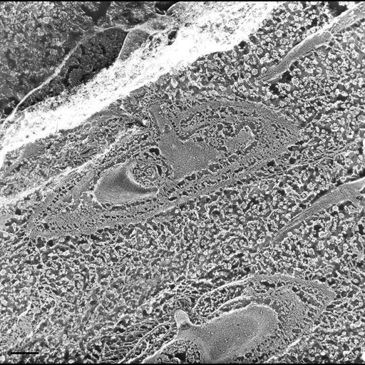  NCBI Organism:Paramecium multimicronucleatum; Cell Types:cell by organism, eukaryotic cell, , ; Cell Components:coated pit, clathrin coat, early endosome; Biological process:endosome organization, clathrin coat assembly;