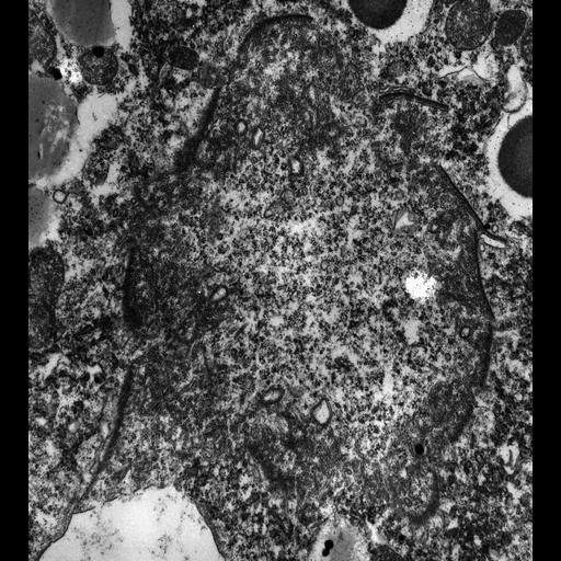  NCBI Organism:Paramecium multimicronucleatum; Cell Types:cell by organism, eukaryotic cell, , ; Cell Components:contractile vacuole, , microtubule, microtubule associated complex; Biological process:water transport, response to non-ionic osmotic stress, microtubule cytoskeleton organization, microtubule bundle formation, microtubule-based process;