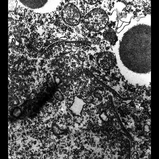  NCBI Organism:Paramecium multimicronucleatum; Cell Types:cell by organism, eukaryotic cell, , ; Cell Components:contractile vacuolar membrane, microtubule associated complex, ; Biological process:water transport, microtubule-based process, ;