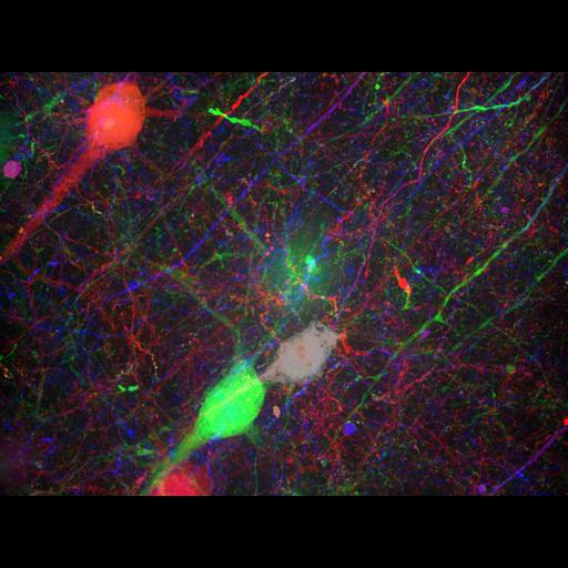  NCBI Organism:Rattus; Cell Types:multipolar neuron, microglial cell; Cell Components:cytoplasm, axon, dendrite, apical pole of neuron; Biological process:gene expression