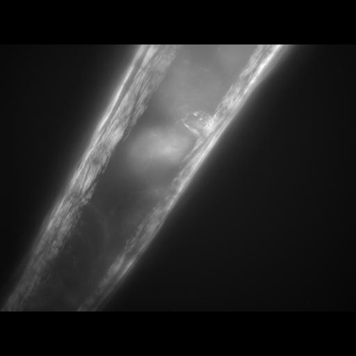  NCBI Organism:Caenorhabditis elegans; Cell Types:muscle cell Cell Components:actin filament Biological process:chronological cell aging