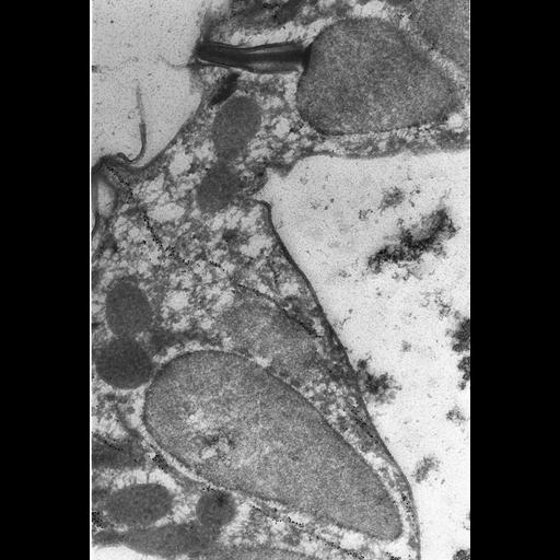  NCBI Organism:Paramecium tetraurelia; Cell Types:cell by organism, eukaryotic cell, , ; Cell Components:cell cortex, cortical microtubule cytoskeleton, cytoproct, microtubule, trichocyst; Biological process:microtubule cytoskeleton organization, microtubule cytoskeleton organization;