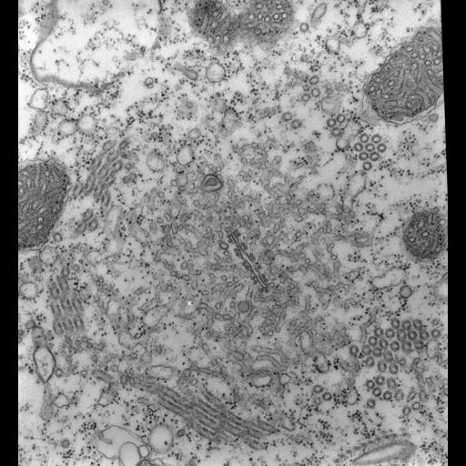  NCBI Organism:Paramecium multimicronucleatum; Cell Types:cell by organism, eukaryotic cell, , ; Cell Components:contractile vacuole, , microtubule associated complex, cytoplasm; Biological process:contractile vacuole organization, microtubule-based process;