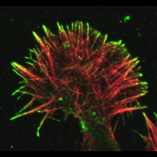  NCBI Organism:mouse/rat NG108-15; Cell Types:glioma, neuroblastoma; Cell Components:growth cone, filopodium; Biological process:cell adhesion mediated by integrin, actin polymerization-dependent cell motility involved in migration of symbiont in host;