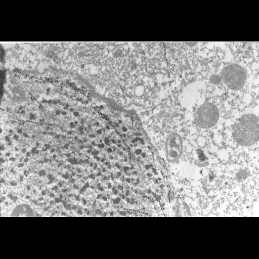  NCBI Organism:Paramecium tetraurelia; Cell Types:cell by organism, eukaryotic cell, , ; Cell Components:macronucleus, nuclear envelope, nuclear microtubule, cytoplasm; Biological process:macronucleus organization, nuclear division, microtubule-based process, microtubule-based movement;