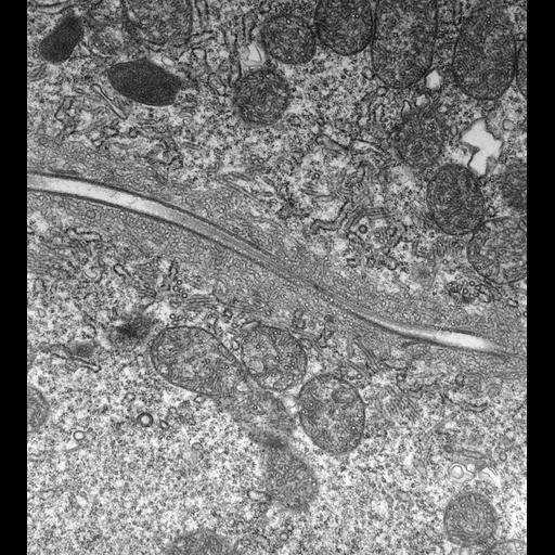  NCBI Organism:Paramecium multimicronucleatum; Cell Types:cell by organism, eukaryotic cell, , ; Cell Components:contractile vacuole, , microtubule associated complex, cytoplasm; Biological process:contractile vacuole organization, microtubule-based process, cytoplasm organization;