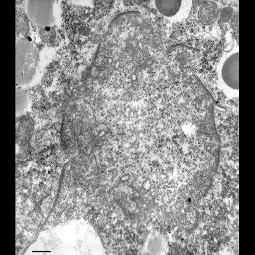  NCBI Organism:Paramecium multimicronucleatum; Cell Types:cell by organism, eukaryotic cell, , ; Cell Components:contractile vacuole, microtubule, microtubule associated complex; Biological process:water transport, microtubule cytoskeleton organization, microtubule bundle formation;