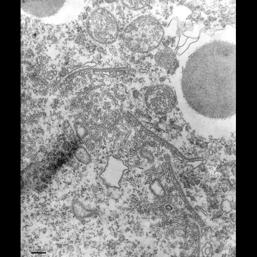  NCBI Organism:Paramecium multimicronucleatum; Cell Types:cell by organism, eukaryotic cell, , ; Cell Components:contractile vacuolar membrane, microtubule associated complex, cytoplasm; Biological process:cellular water homeostasis, microtubule-based process, cytoplasm organization;